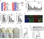 ANGPTL4 Antibody in Immunohistochemistry, Immunohistochemistry (Paraffin) (IHC, IHC (P))