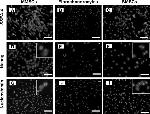 SSEA4 Antibody in Immunohistochemistry (IHC)