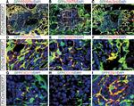 CD140b (PDGFRB) Antibody in Immunohistochemistry (IHC)