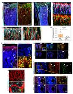 CD140b (PDGFRB) Antibody in Immunohistochemistry (IHC)