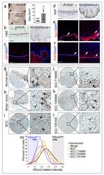 Podoplanin Antibody in Immunohistochemistry (IHC)