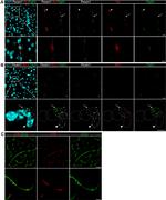 CD140b (PDGFRB) Antibody in Immunohistochemistry (IHC)