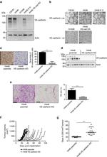 CD144 (VE-cadherin) Antibody in Immunohistochemistry (IHC)