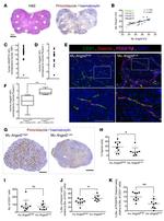 PDGFRB Antibody in Immunohistochemistry (IHC)