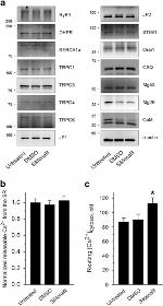 JPH2 Antibody in Western Blot (WB)