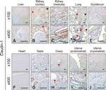 Claudin 1 Antibody in Immunohistochemistry (IHC)