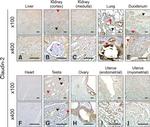 Claudin 2 Antibody in Immunohistochemistry (IHC)