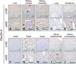 Claudin 4 Antibody in Immunohistochemistry (IHC)