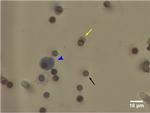 CD144 (VE-cadherin) Antibody in Immunohistochemistry (IHC)