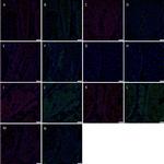 SOX2 Antibody in Immunocytochemistry (ICC/IF)