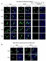 Estrogen Receptor beta Antibody in Immunocytochemistry (ICC/IF)