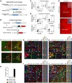 CD140a (PDGFRA) Antibody in Immunohistochemistry (IHC)