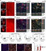 CD140a (PDGFRA) Antibody in Immunohistochemistry (IHC)