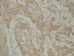 VEGF Antibody in Immunohistochemistry (IHC)