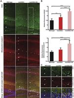 SDHA Antibody in Immunohistochemistry (Paraffin) (IHC (P))