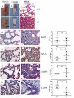 CD34 Antibody in Immunohistochemistry (IHC)