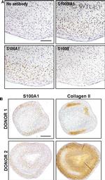 S100A1 Antibody in Immunohistochemistry (IHC)