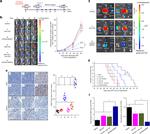 FOXP3 Antibody in Immunohistochemistry (IHC)