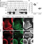 alpha-Cardiac Actin Antibody in Immunocytochemistry, Immunohistochemistry (ICC/IF, IHC)