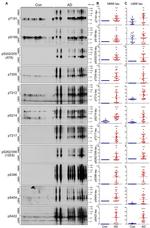 Phospho-Tau (Ser214) Antibody in Western Blot (WB)