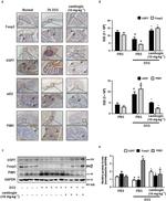 FOXP3 Antibody in Immunohistochemistry (IHC)