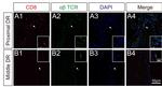 TCR alpha/beta Antibody in Immunocytochemistry, Immunohistochemistry (ICC/IF, IHC)