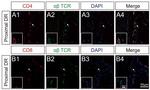 TCR alpha/beta Antibody in Immunocytochemistry, Immunohistochemistry (ICC/IF, IHC)