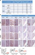 Phospho-SMAD2 (Ser465, Ser467) Antibody in Immunohistochemistry (IHC)