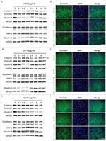 beta Catenin Antibody in Western Blot (WB)