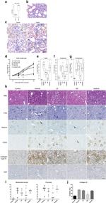 Ki-67 Antibody in Immunohistochemistry (Paraffin) (IHC (P))