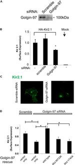 Golgin-97 Antibody in Immunocytochemistry (ICC/IF)