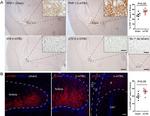 Phospho-Tau (Thr212) Antibody in Immunohistochemistry (IHC)