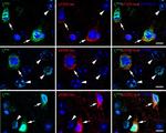 Phospho-Tau (Ser262) Antibody in Immunohistochemistry (IHC)