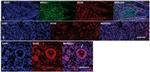 NR5A1 Antibody in Immunohistochemistry (IHC)