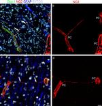 Neural/Glial Antigen 2 (NG2) Antibody in Immunohistochemistry (IHC)