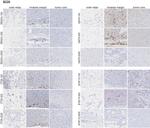 CD45R (B220) Antibody in Immunohistochemistry (IHC)