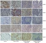 ADAM9 Antibody in Immunohistochemistry (IHC)