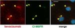 IGF2R Antibody in Immunocytochemistry (ICC/IF)