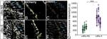 mCherry Antibody in Immunocytochemistry, Immunohistochemistry (ICC/IF, IHC)