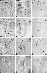 MTCO2 Antibody in Immunohistochemistry (IHC)