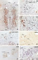 MTCO2 Antibody in Immunohistochemistry (IHC)