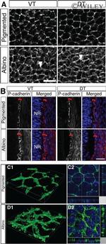 P-cadherin Antibody in Immunohistochemistry (IHC)