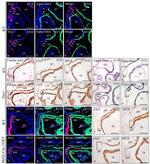 TBX1 Antibody in Immunohistochemistry (IHC)