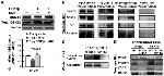 BTRC Antibody in Western Blot (WB)