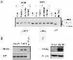 PPAR gamma Antibody in Western Blot (WB)