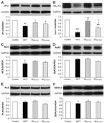 Sodium/Calcium Exchanger Antibody in Western Blot (WB)