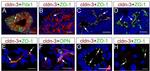 Claudin 3 Antibody in Immunohistochemistry (IHC)