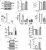 Calsequestrin Antibody in Western Blot (WB)