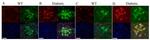 CD140b (PDGFRB) Antibody in Immunohistochemistry (IHC)