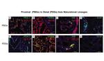 Ki-67 Antibody in Immunohistochemistry (IHC)